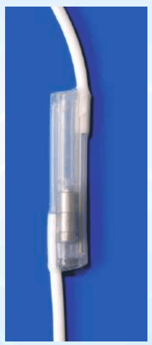 "Z" Flow Hydrocephalous Shunt System